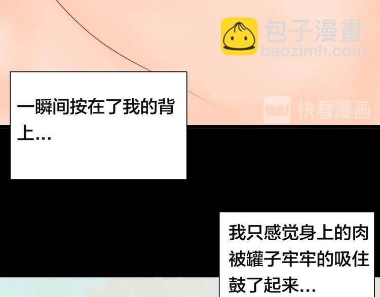 第113话 拔罐
