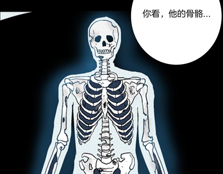 第63话 骨头溶解症（上）