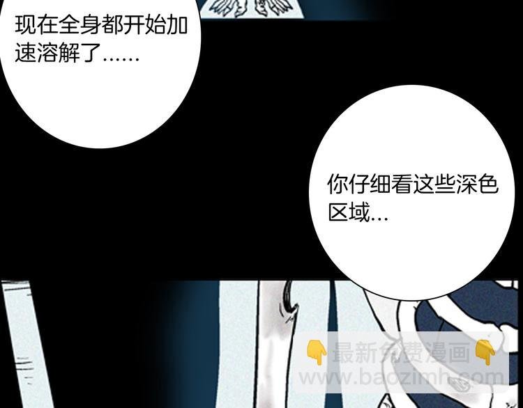 第63话 骨头溶解症（上）