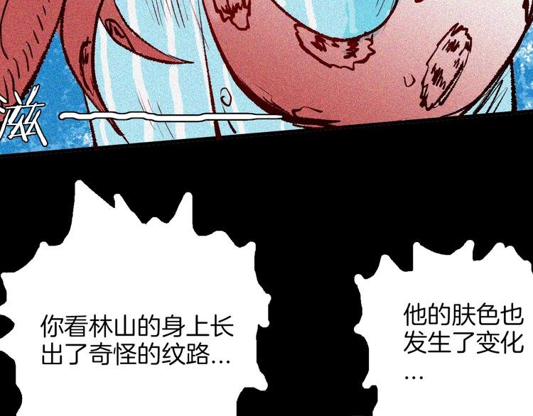 第64话 骨头溶解症（下）