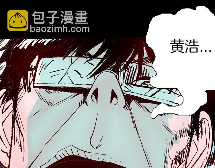 第64话 骨头溶解症（下）