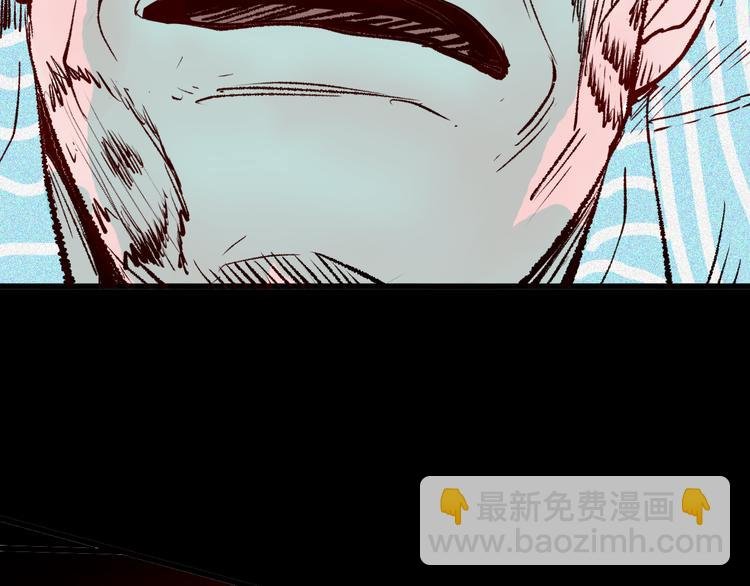 第64话 骨头溶解症（下）