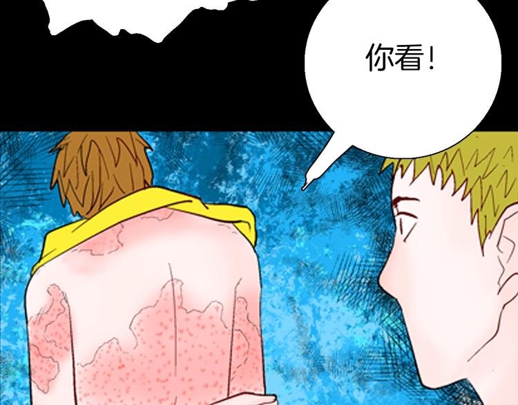 第92话 皮肤病患者