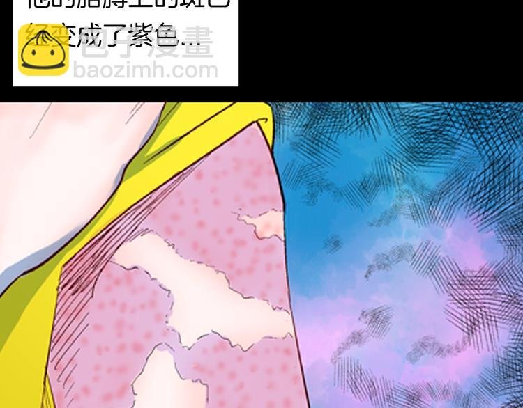 第92话 皮肤病患者