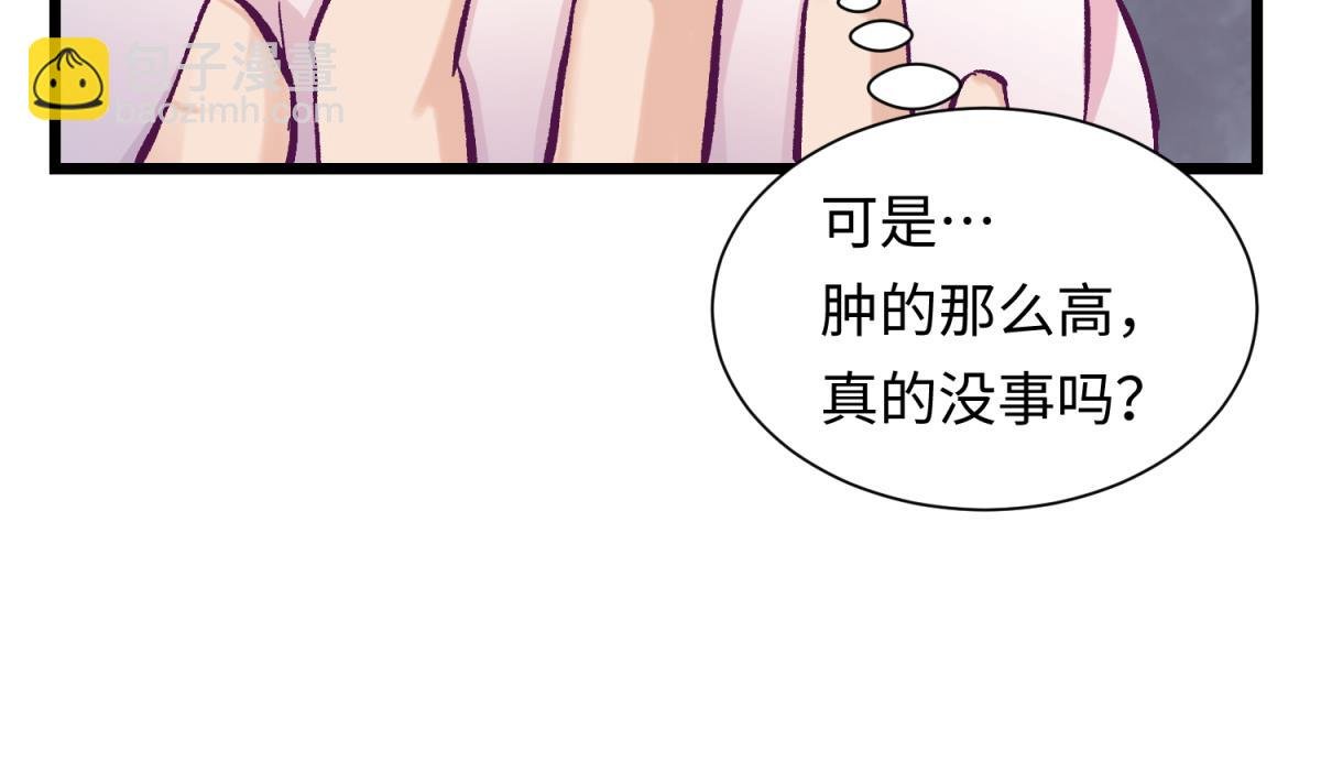 第142话 你肿了么？