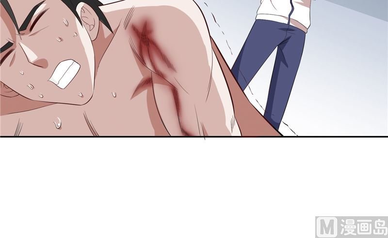 第57话 发现黑皮