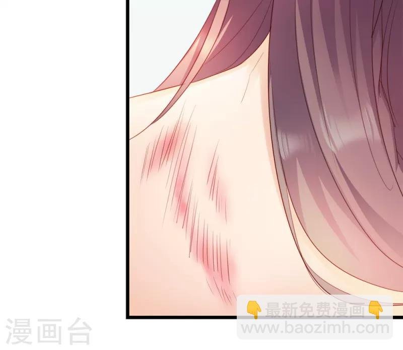 第57话 擦药