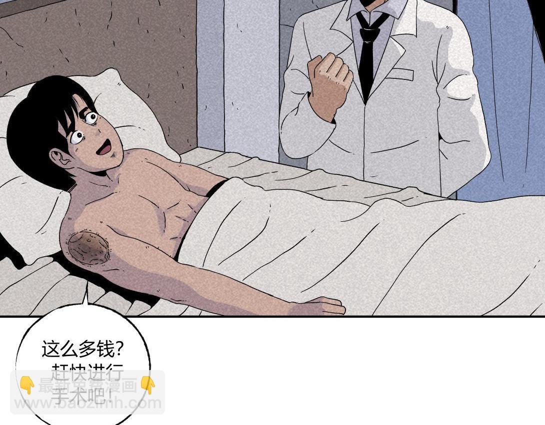 第32话 种植体＆寄生胎