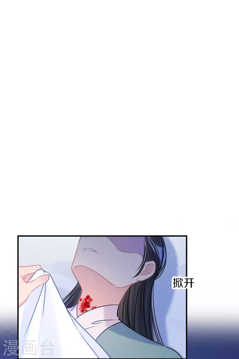 第43话2 风波再起