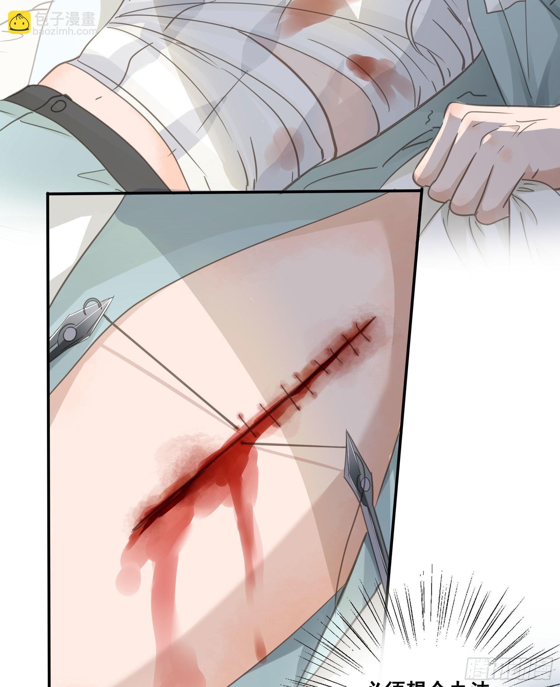 口哨