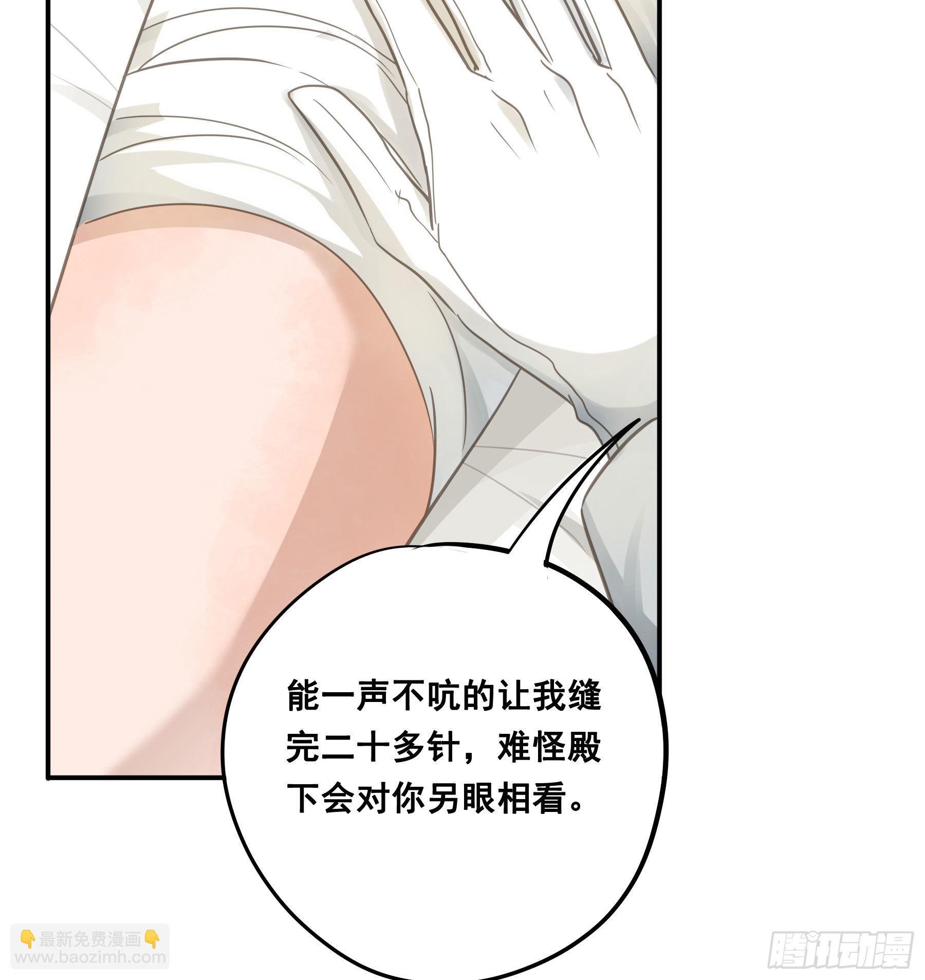 口哨
