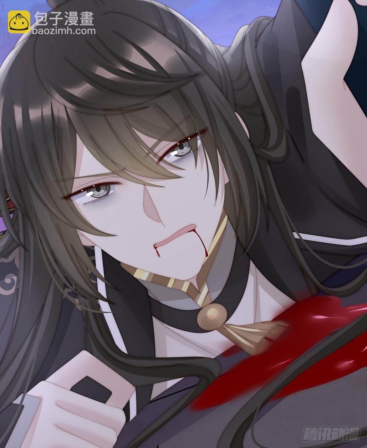 重伤